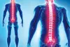 World Spine Day: गलत स्थिति में लंबे समय बैठने से बढ़ी रीढ़ में दर्द की समस्या