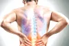 World Spine Day: राजस्थान में रोड एक्सीडेंट से 43% लोगों को होती है स्पाइन इंजरी, पैरालिसिस होने की रहती है संभावना