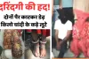 दरिंदगी की सारी हदें पार : सुनसान जगह बुलाकर चांदी के कड़े के लिए काटे महिला के पैर, झाड़ियों से रेंगती हुई सड़क पर पहुंचकर मांगी मदद: वारदात स्थल पर मिले महिला के कटे पैर और चप्पलें