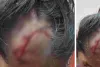 4 साल की बच्ची पर जर्मन शेफर्ड का हमला : सिर नोंचकर किया लहूलुहान, पड़ोसी के खिलाफ मुकदमा दर्ज  