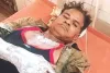 कचौड़ी के पैसे मांगना पड़ा भारी, दुकानदार पर खौलता तेल उड़ेलकर आरोपी फरार