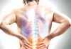 World Spine Day: राजस्थान में रोड एक्सीडेंट से 43% लोगों को होती है स्पाइन इंजरी, पैरालिसिस होने की रहती है संभावना