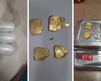 रेक्टम में कैप्सूल के रूप में छिपा कर लाया 42 लाख से ज्यादा का सोना, जयपुर एयरपोर्ट पर कस्टम ने धरा