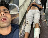 दिल्ली से जयपुर लाते समय एसआई की पिस्टल छीन की फायरिंग, जवाबी फायरिंग में बदमाश के पैर में लगी गोली