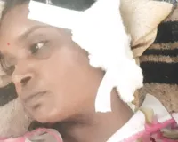 पत्नी को जूस पिलाने के बहाने जंगल में ले जाकर चाकू से काटा कान, आरोपी हिरासत में