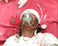 आरपीएफ जवानों की चैकिंग के दौरान ट्रेन से कूदा नाबालिग : बच्चा गंभीर घायल, 2 पुलिसकर्मी सस्पेंड