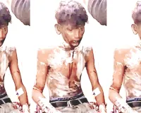 युवती से मिलने आया युवक बनाया बंधक : पेट्रोल छिड़कर लगाई आग, 30 प्रतिशत झुलसा, बाइक को भी फूंका