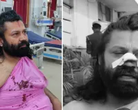अविमुक्तेश्वरानंद सरस्वती के खिलाफ यौन उत्पीडऩ का मामला दर्ज करवाने वाले आशुतोष ब्रह्मचारी पर जानलेवा हमला, लहूलुहान हालत में पहुंचे प्रयागराज, पुलिस जांच शुरू