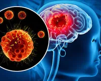 ब्रिटेन में दिमागी बुखार का प्रकोप: मेनिंजाइटिस बी और डब्ल्यू स्ट्रेन के मामले सर्वाधिक, स्वास्थ्य विभाग ने जारी किया ‘हाई अलर्ट’