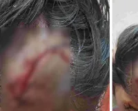 4 साल की बच्ची पर जर्मन शेफर्ड का हमला : सिर नोंचकर किया लहूलुहान, पड़ोसी के खिलाफ मुकदमा दर्ज  