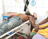 सोते युवक पर हमला : युवक के सिर में धंसी कुल्हाड़ी, निकालने की प्रक्रिया बनी जोखिम भरी
