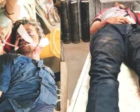 स्कूटी-बाइक की भिड़ंत में स्कूल से लौटते छात्र की मौत, दूसरा छात्र और बाइक सवार गंभीर घायल