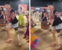बस हादसे में खोया पैर, अब नेहा एक पैर पर गरबा कर पेश कर रहीं मिसाल