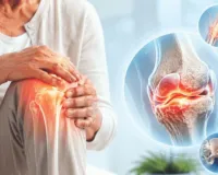 वर्ल्ड आर्थराइटिस डे : वायरल इंफेक्शन और जहरीली हवा बनी नई मुसीबत, चिकनगुनिया के बाद जोड़ों को स्थायी नुकसान पहुंचा रहा ऑर्थराइटिस
