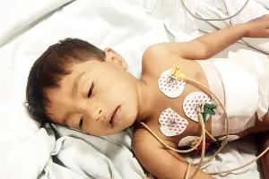  दो साल की बच्ची के लीवर में घुसी 2 इंच लम्बी सूई ऑपरेशन कर बाहर निकाली, एसएमएस अस्पताल के चिकित्सकों ने फिर किया कमाल