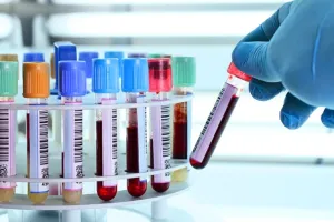 जानिए कौनसा ब्लड ग्रुप है सबसे दुर्लभ, भारत मेें कितने व्यक्तियों में पाया जाता है