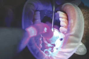 प्रयोगशाला में मानव दांत बनाने में कामयाबी : वैज्ञानिकों ने लैब में बनाए इंसानी दांत, फिलिंग और डेंटल इम्प्लांट से मिलेगा छुटकारा