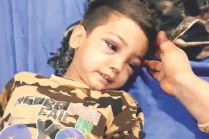 तेज रफ्तार कार ने महिला और चार बच्चों को रौंदा, चालक सभी को दस फीट तक घसीटते ले गया