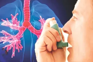 वर्ल्ड अस्थमा डे : प्रदूषण और बदलती जीवनशैली ने बढ़ाया अस्थमा रोगियों का मर्ज 