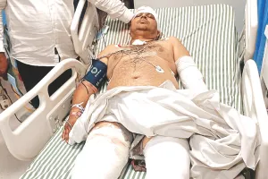 आबादी भूमि पर कब्जा हटवाने गए सरपंच पर किया हमला, पैर और बायां हाथ तोड़ा