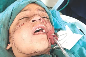 युवक ने तलवार लेकर घर में मचाया आतंक : मां, भाई, भाभी, बेटी और पत्नी पर किया हमला