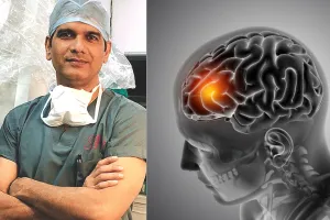 तेजी से बढ़ रहे ब्रेन ट्यूमर के मामले : शुरुआती लक्षणों पर ध्यान नहीं देना हो सकता है जानलेवा, देश में हर साल 28 हजार से ज्यादा नए मामले आ रहे सामने