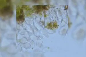 केरल में दिमाग खाने वाले अमीबा का कहर : 61 मामले, 19 मौतें; स्वास्थ्य मंत्री ने जताई गंभीर चिंता