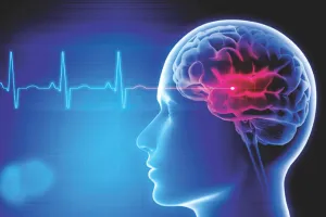 वर्ल्ड ब्रेन स्ट्रोक डे : राजस्थान में हर साल 6 से 7 हजार नए केस, 700 से अधिक मौतें