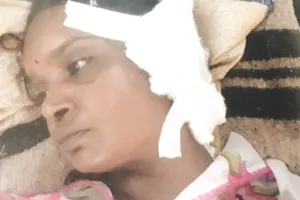 पत्नी को जूस पिलाने के बहाने जंगल में ले जाकर चाकू से काटा कान, आरोपी हिरासत में