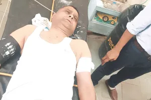 फ्लैट में भीषण आग के बीच सिलेंडर फटा : हेड कांस्टेबल घायल, दमकलकर्मी के बाल झुलसे ; अपार्टमेंट में रहने वाले लोगों में हड़कंप 