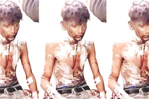 युवती से मिलने आया युवक बनाया बंधक : पेट्रोल छिड़कर लगाई आग, 30 प्रतिशत झुलसा, बाइक को भी फूंका
