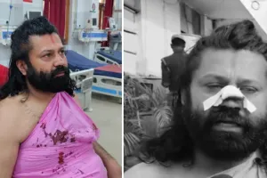 अविमुक्तेश्वरानंद सरस्वती के खिलाफ यौन उत्पीडऩ का मामला दर्ज करवाने वाले आशुतोष ब्रह्मचारी पर जानलेवा हमला, लहूलुहान हालत में पहुंचे प्रयागराज, पुलिस जांच शुरू