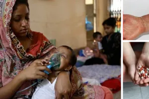 बांग्लादेश में खसरे से हाहाकार : एक दिन में 17 लोगों की मौत; तेजी से बढ़ रहे केस, सरकार ने जारी किया अलर्ट