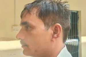 भिण्ड में चक्की मालिक बना हैवान : 5 रुपए के लिए ग्राहक का काटा कान, जानें क्या है मामला