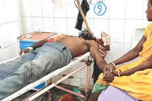 सोते युवक पर हमला : युवक के सिर में धंसी कुल्हाड़ी, निकालने की प्रक्रिया बनी जोखिम भरी