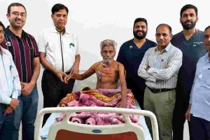 एसएमएस अस्पताल में दो किलो वजनी दुर्लभ छाती के ट्यूमर की सफल सर्जरी, मरीज को मिला नया जीवन