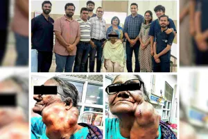 75 वर्षीय महिला की गर्दन से निकाली 25×25 सेंटीमीटर की विशाल गांठ, एसएमएस में दुर्लभ ऑपरेशन सफल