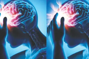 वर्ल्ड ब्रेन स्ट्रोक डे : प्रदेश में ब्रेन स्ट्रोक के हर साल 6 से 7 हजार नए मामले, 700 से 900 मौतें