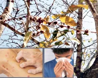 शहर की हवा में घुले परागकण, अस्थमा और एलर्जी के मरीजों की बढ़ी मुसीबतें